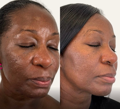 Duo Anti-Imperfections Centella