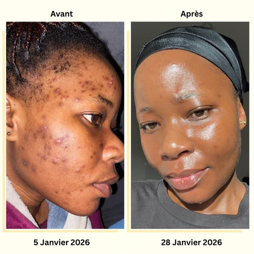 Duo Anti-Imperfections